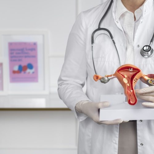 Dia da Luta contra a Endometriose: atenção básica é aliada no diagnóstico precoce e no cuidado contínuo