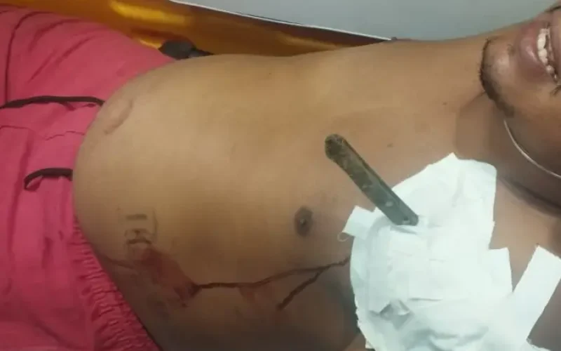 FACA CRAVADA NO PEITO! Homem de 24 anos é socorrido após tentativa de homicídio em Gongogi