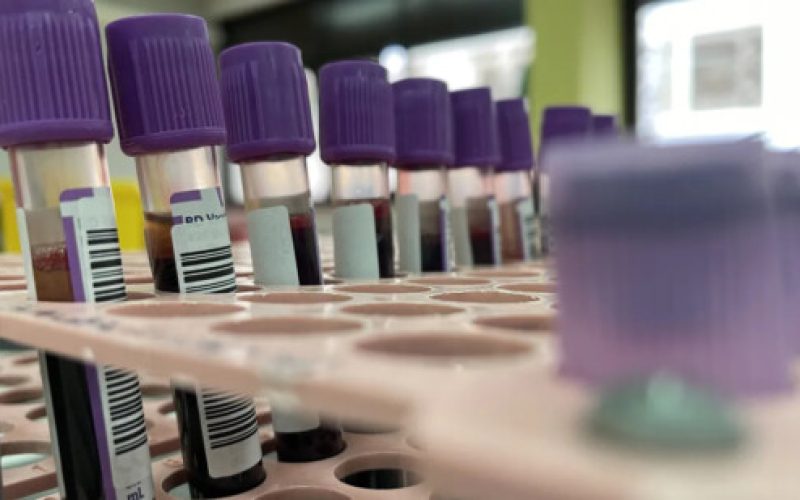 Estudo aponta que jejum prolongado pode ser desnecessário em diversos exames de sangue