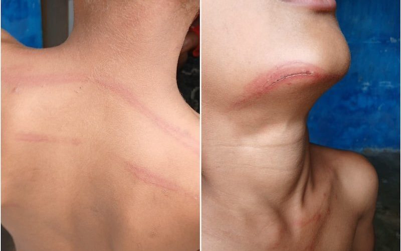 Professor é denunciado por agredir garoto de 8 anos com cipó de goiabeira em Ilhéus